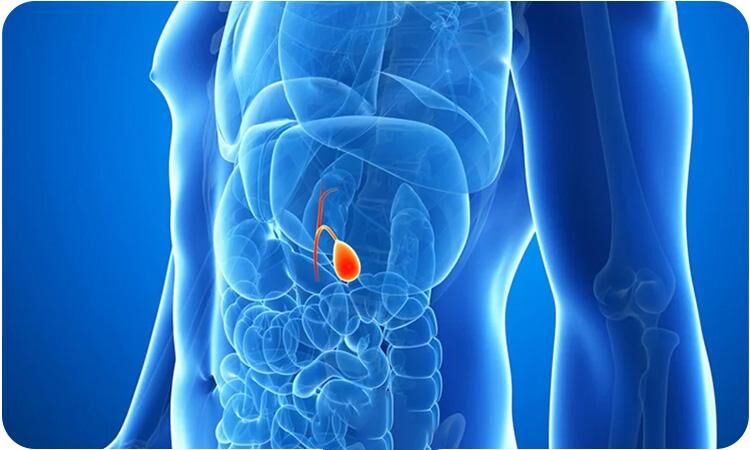 عمل کیسه صفرا با لیزر خطرناک است؟ مراقبتهای لازم