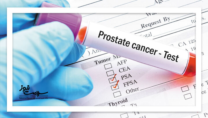 تست جدید و پیشرفته تشخیص سرطان پروستات