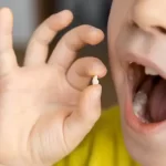 تعبیر خواب کندن دندان با دست بدون خونریزی امام صادق و ابن سیرین و کندن دندان کرمو