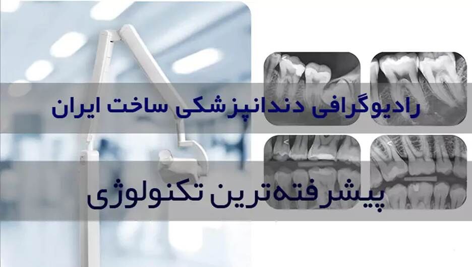 رادیوگرافی دندانپزشکی: پیشرفتهترین نوع تصویربرداری