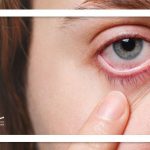 پیش‌بینی اسکیزوفرنی با آزمایش چشمی ساده