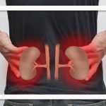 علائم نارسایی حاد کلیه – سلامت نیوز
