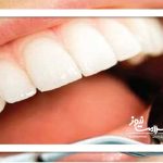 تحقق یک رویا در حیطه دندانپزشکی