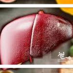 چند توصیه کاربردی برای پاکسازی کبد