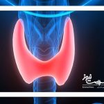 تیروئید کودکان در تیررس آلودگی هوا و نور شبانه!