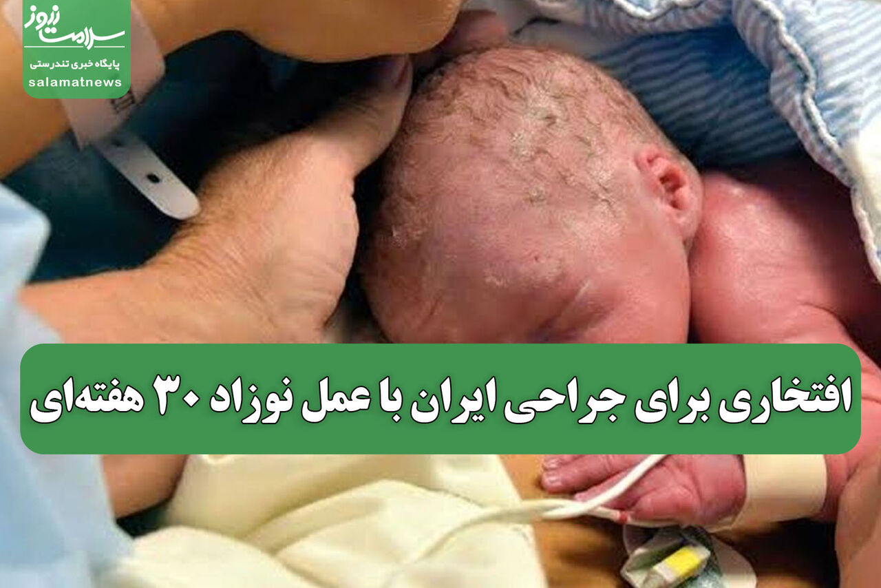 افتخاری برای جراحی ایران با عمل نوزاد 30 هفتهای