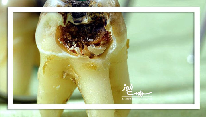 تبلیغات محصولات ضد پوسیدگی دندان تا چه میزان واقعی است؟