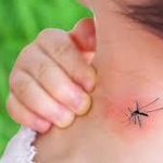 چه افرادی نسبت به بقیه بیشتر مستعد گزش حشرات هستند؟