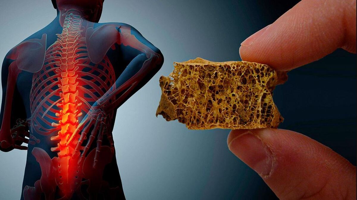 جلوگیری از پوکی استخوان با این خوردنیها