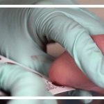 این علائم از ابتلای کودک به فنیل کتونوری خبر می‌دهد