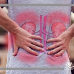 هشدار تابستانی برای کلیه‌ها | کم‌آبی، خطری خاموش در روزهای داغ