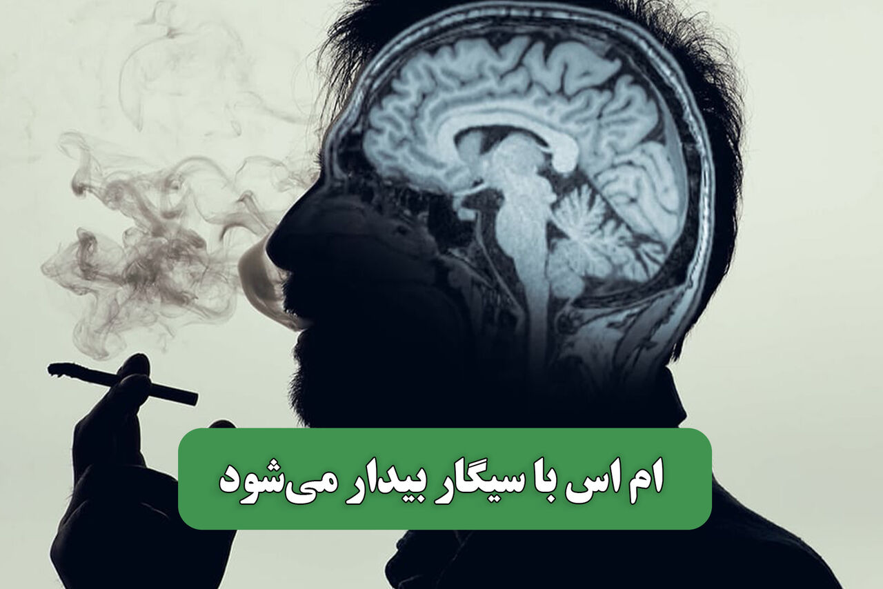 ام اس با سیگار بیدار میشود