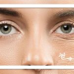 پشت مخفی کاری سن واقعی چیست؟