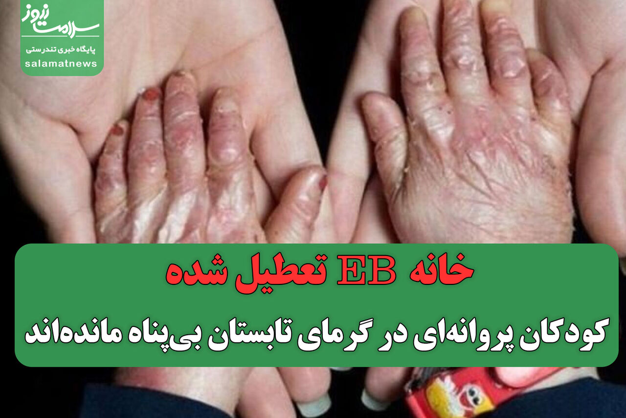 خانه EB تعطیل شده/ کودکان پروانهای در گرمای تابستان بیپناه ماندهاند