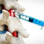 امکان ترمیم اعصاب نخاع با تزریق یک دوز ژل نانویی