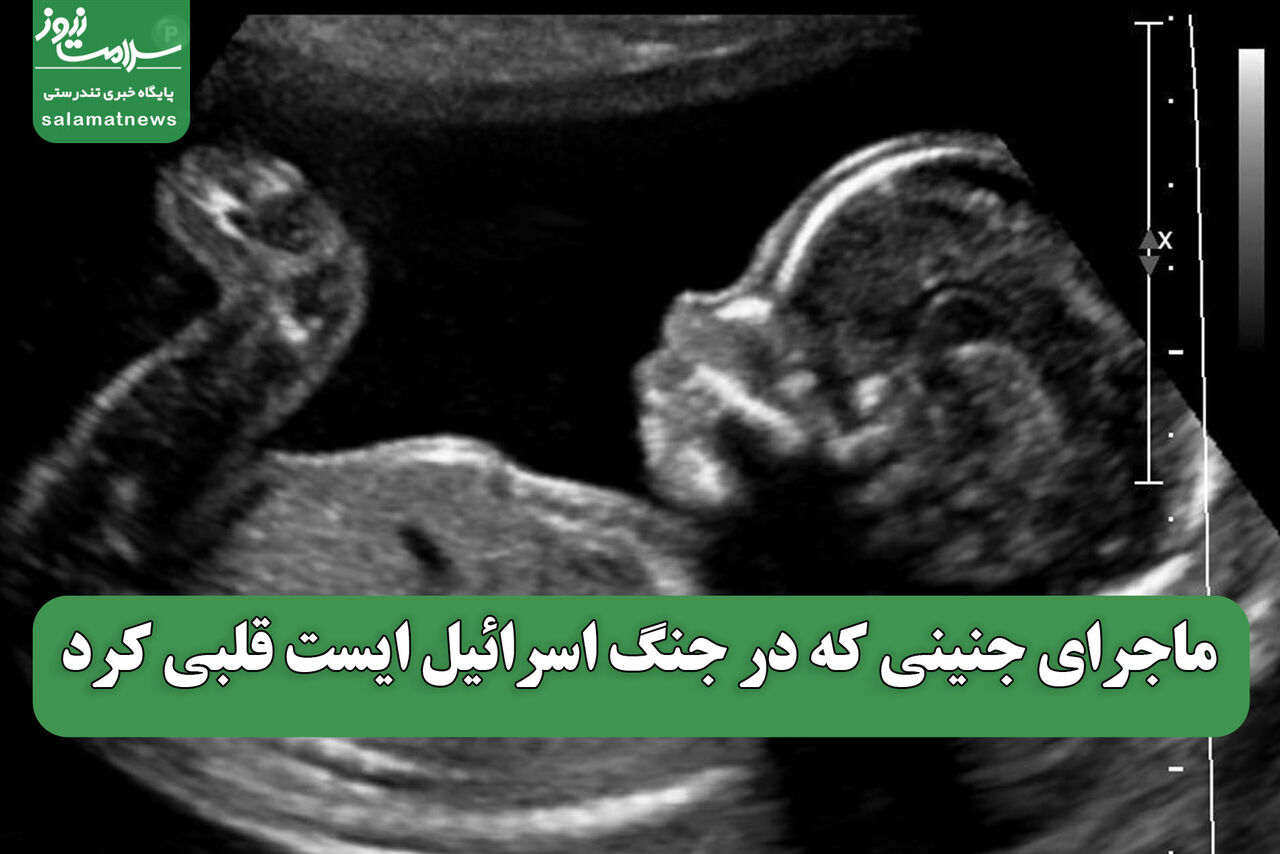 ماجرای جنینی که در جنگ اسرائیل ایست قلبی کرد