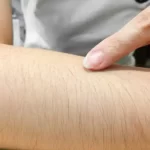 تعبیر خواب موی دست زن برای زن متاهل و باردار و دختر مجرد از روانشناسی