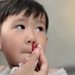 تعبیر خواب خون دماغ شدن برادر برای زن متاهل و باردار و دختر مجرد از روانشناسی