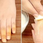 روش‌های ساده برای پاک کردن لکه زردچوبه از ناخن و دست