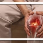 کشف مرحله «خاموش» آرتریت روماتوئید